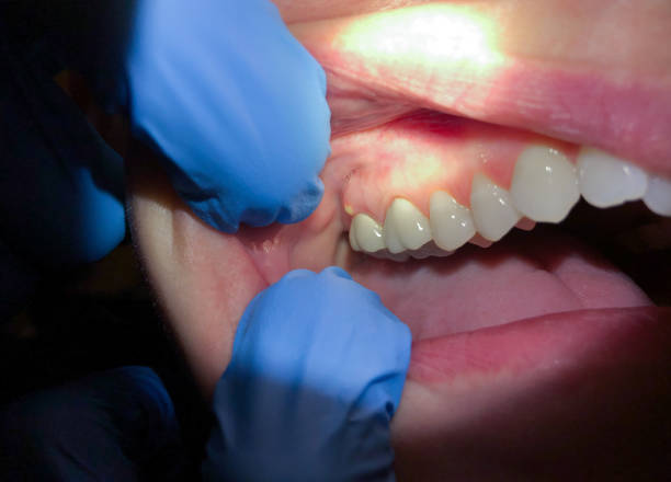 Best Walk-In Emergency Dental Services in Mount Jackson, VA